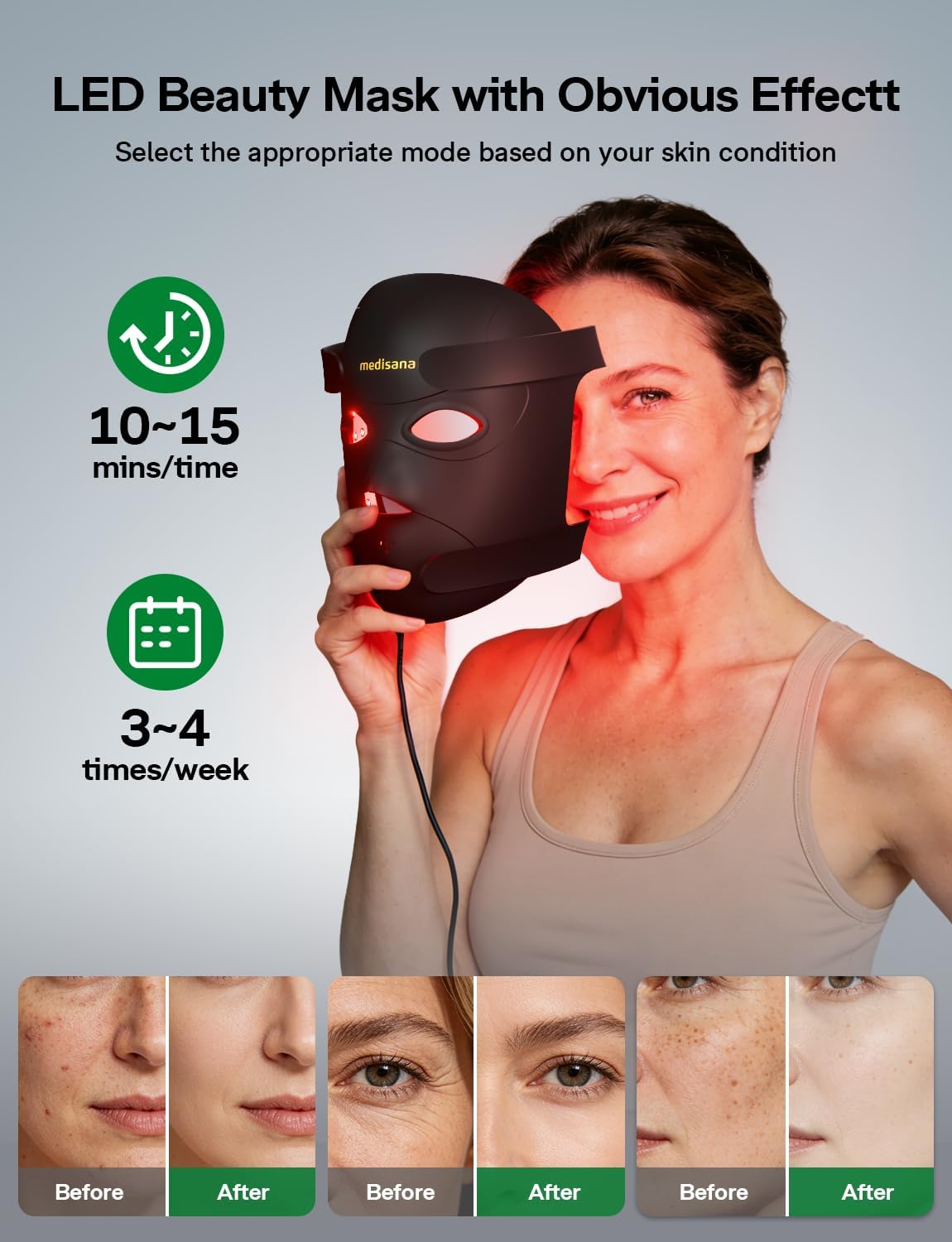 Medisana 3D Red Light Therapy For Face, 336 LEDs With 3 Modes - Nir 830Nm, Red 630Nm, Blue 415Nm - 3D Ergonomic Silicone Design, Cordless & Rechargeable LED Face Mask, Skincare Gifts For Women